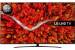 LG 70UP81003 - 177 cm